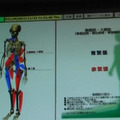 骨格のゆがみを3Dで表示