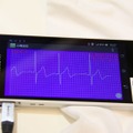 アプリしだいでスマホやタブレットが心電図計にもなる
