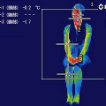 サーモグラフィ調査（エアコン30分経過の場合）
