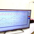 マイクロ波センサモジュールを使った人の心拍・呼吸・体動を測定する様子。障害物越しでも検知することが可能とのこと（画像はプレスリリースより）