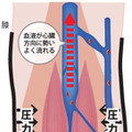 「JETLEGS」は一般医療機器として認定を受けており、市販のサポートストッキングよりも高い圧迫圧で血流をスムーズにする（画像はプレスリリースより）