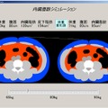 内臓脂肪シミュレーションの例：CTのようでCTでない