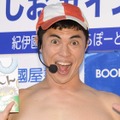 「骨折おっぱっぴー！」小島よしお、SNSで右足骨折を報告 画像