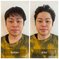 井上裕介、美容施術のビフォーアフターを公開 「顔が違う…」「やってみたいわ！」 画像