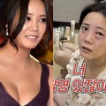 顔面トラブル続きの韓国女優、今度は異常な目の腫れに困惑「撮影直前に緊急事態」 画像