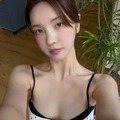 “パク・ソジュンとの熱愛説”で一躍時の人に、韓国美女ユーチューバーが流行りの歯科施術を報告