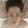 「こわっ！」ノンスタ井上、美容施術中のショット公開し反響 画像