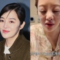 別人級に腫れた顔…『キム秘書』女優ファン・ボラ(42)、体外受精の副作用で健康悪化「体はボロボロ」