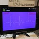 【NTT R＆Dフォーラム2014 Vol.2】弱点は胸毛……ウェアラブル生体センサーを東レと共同開発 画像