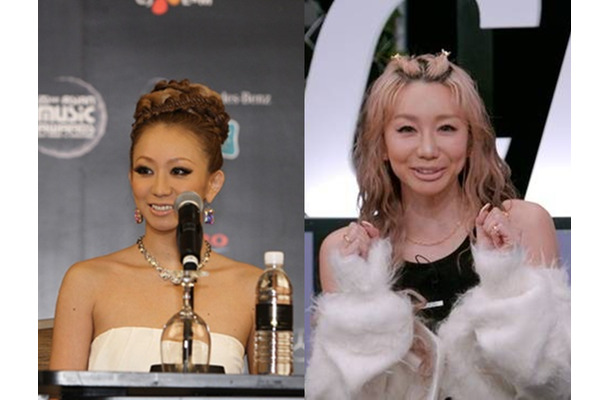 倖田來未（43）の第2子妊娠が韓国でも注目　“あの一言”とセットで「高齢出産とは何か」を問う報じられ方も