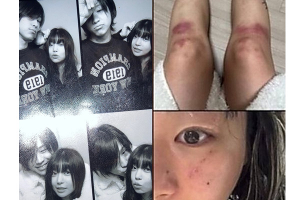 “デートDV被害”を暴露→立場を翻した韓国女性ラッパー、加害者と指名した元恋人と復縁を示唆