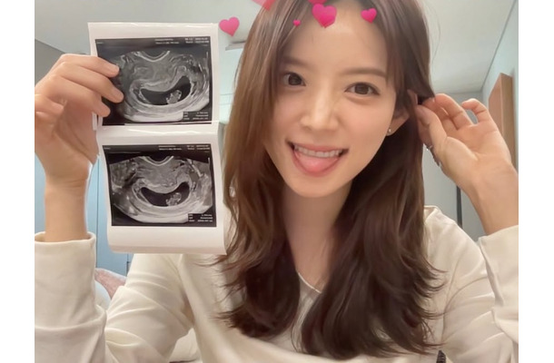 「夫と一緒にシャワー」発言に賛否…授かり婚の韓国インフルエンサー、番組演出に理解求める