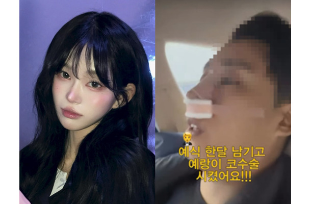“整形モンスター”と自身も認めた韓国インフルエンサー、婚約者にも整形をさせる 亡き父は元巨人投手