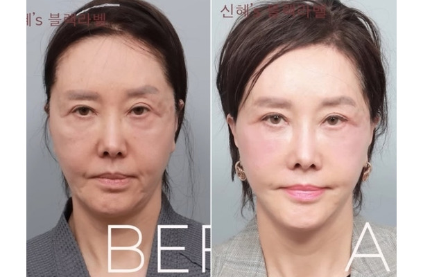限界ギリギリまで整形、60代とは思えないビジュアルに！韓国ベテラン女優の潔すぎる告白が話題