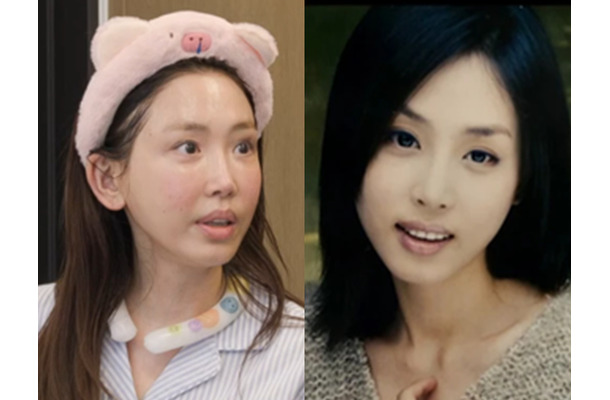 目の整形を7回した韓国女優、その切ない理由「もっと綺麗になろうと欲を出したのではなく…」