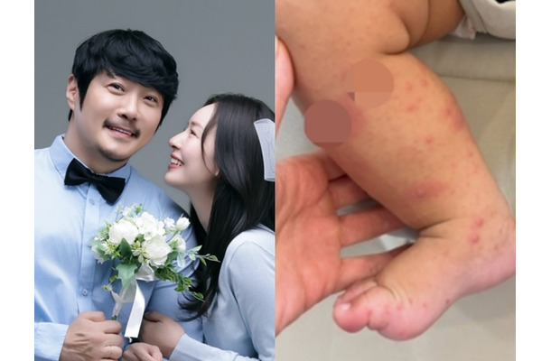 韓国人夫のために日本国籍を捨てた女性、生後8カ月の息子が手足口病に「先輩ママの話が聞きたい」