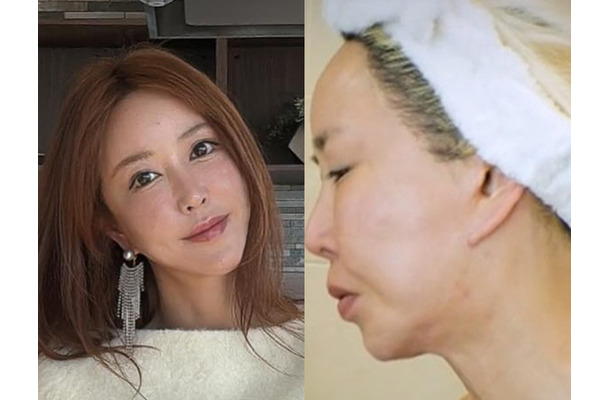 横浜で生まれ育った元韓国トップアイドル、自身もショックを受けた外見の変化「私の顔どうした」