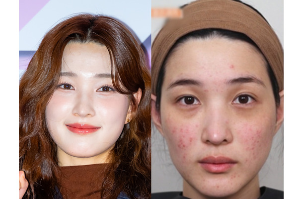 「育ててるのは元夫でしょ」元韓国アイドル、“育児で”ボロボロになった肌公開も視聴者は不快感