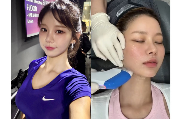 “韓国で最もグラマラス”と言われた元芸人、医師の年下彼氏に顔をお任せ！美容施術VLOGが話題