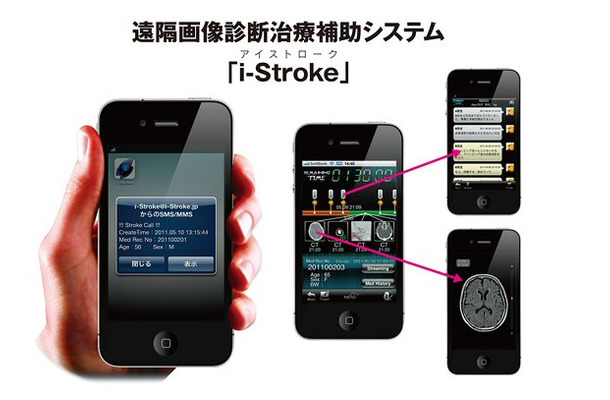 i-Stroke