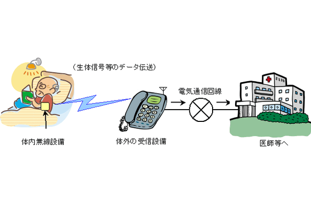 　総務省は21日、体内植込型医療用遠隔監視システムを実用化するための特定省電力無線局制度の整備に必要な技術的条件案「400MHzメガヘルツ帯を利用した体内無線設備の利用形態拡大に向けた技術的条件案」を作成し、12月21日午後5時までの間、広く意見を公募する。