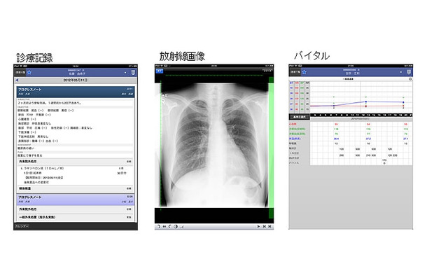 モバイル端末で閲覧可能な診療情報の一部（例） 