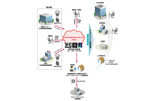 サービスのイメージ図。CTやMRIなどの検査画像を保管・閲覧・管理するための「医療用画像管理システム（PACS）」をクラウド上に構築し、患者情報や過去の検査履歴などと合わせて統合的に閲覧、共有できる（画像はプレスリリースより）
