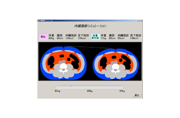 内臓脂肪シミュレーションの例：CTのようでCTでない