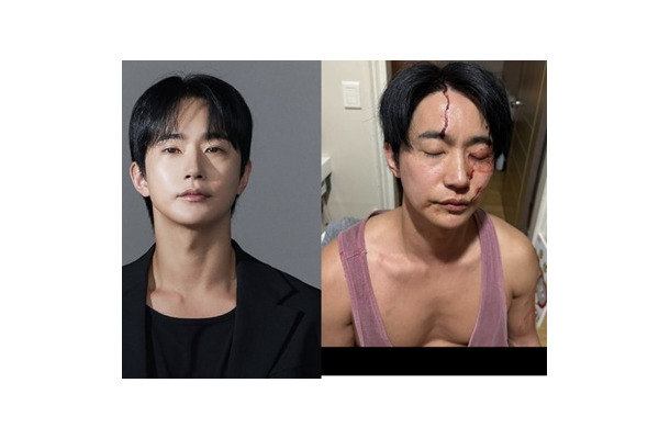 「性病をうつされ暴力もあった」と告発された韓国俳優が反論「彼女に殴られた」