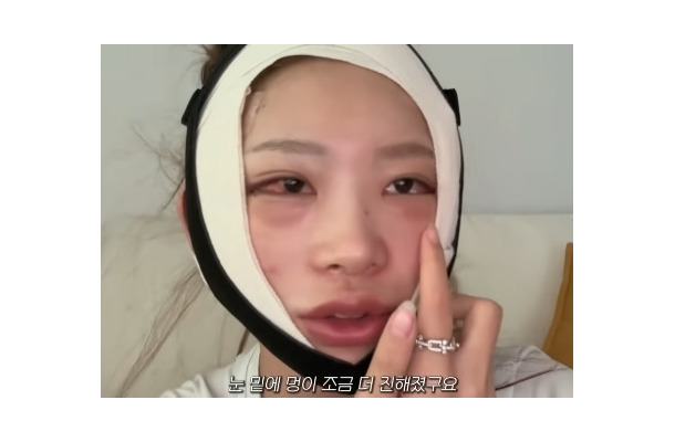 まるで“顔面フルリフォーム”…急逝した元巨人投手・国民的女優が両親　韓国インフルエンサーが大規模整形