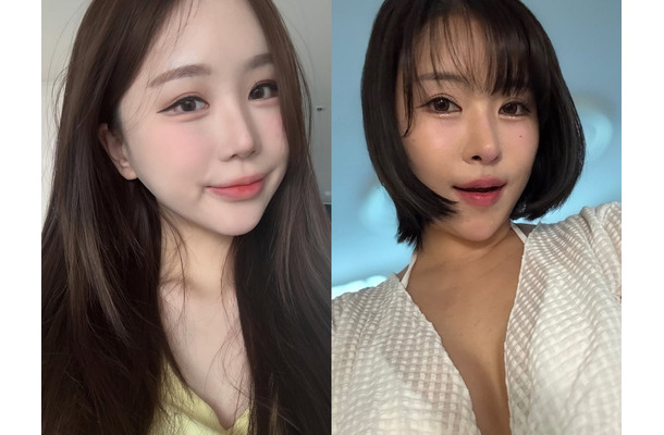 「整形してもブス」“元カレは日本人”の韓国豊胸芸人と、中2から整形のユーチューバーが語る「顔を変えたメリット」