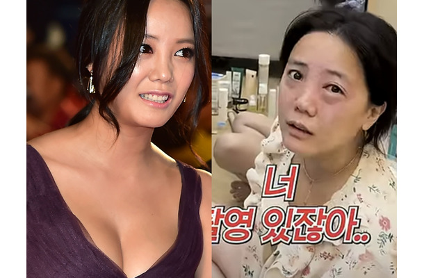 顔面トラブル続きの韓国女優、今度は異常な目の腫れに困惑「撮影直前に緊急事態」