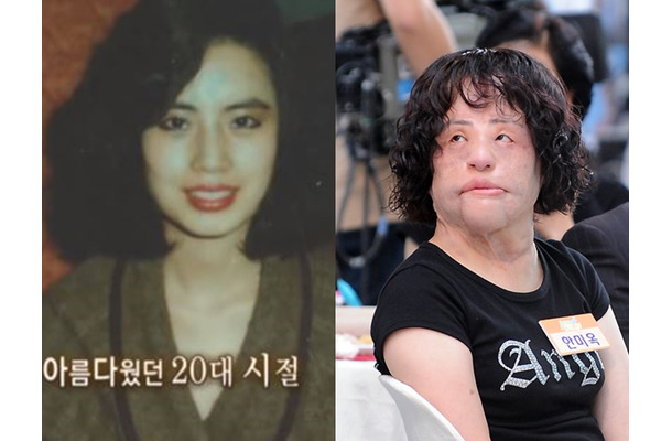 美女がなぜ“扇風機おばさん”に？死去の秘話が明かされる…違法整形、顔に工業用シリコンを注入