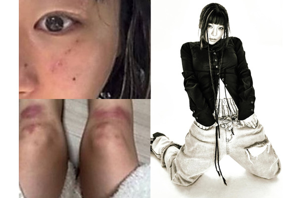 ボコボコに殴られたような写真はなんだったのか…元恋人のDV疑惑を提起した韓国女性ラッパー、立場を翻す