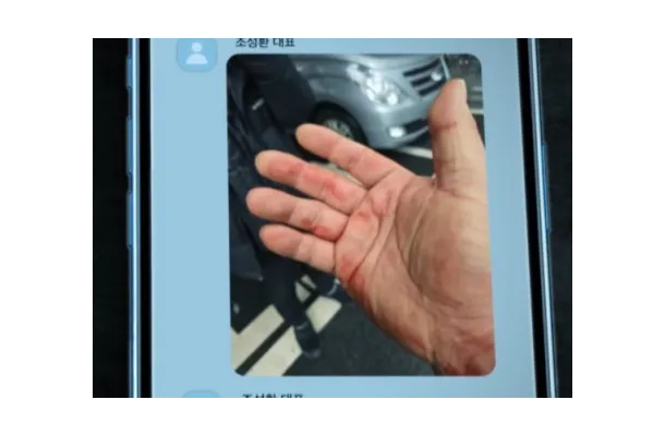 暴行の跡まで!! Ｊリーグのパワハラ問題に匹敵するか。韓国“ランシュー界の帝王”パワハラ事件の真相はいかに