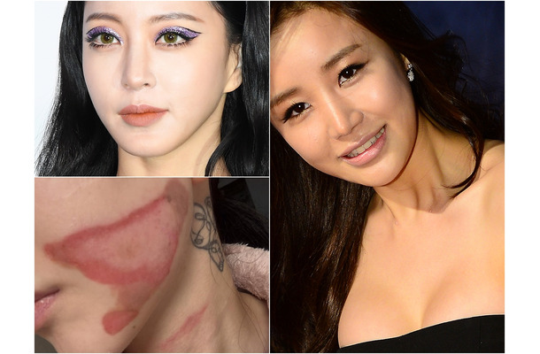 整形に美容施術、もはや“美”は金で買う時代　その裏に潜むリスクに直面した韓国芸能人たち