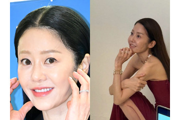 「撮影現場で何度も倒れた」過去も…韓国女優、骨が浮き出るほどやせ細った姿に心配の声 画像