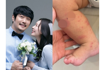 韓国人夫のために日本国籍を捨てた女性、生後8カ月の息子が手足口病に「先輩ママの話が聞きたい」 画像