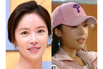 整形に失敗し、母から「顔を見たくもない」と言われる…韓国女優、憂うつな思いをした過去 画像