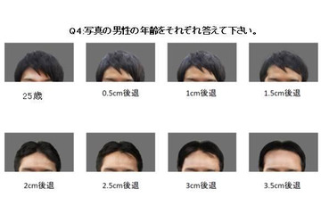 頭髪が1cm後退すると、年齢は平均5.7歳老けてみえる? 画像