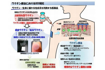 貼るインフルエンザワクチン、5年後実用化へ 画像