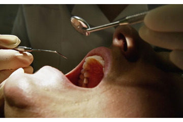 歯科医院で治療可能な“口臭”治療や、その対策とは？ 画像