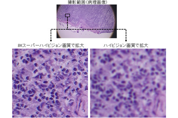 8K技術で遠隔医療！NTTデータ経営研究所らが実証実験へ 画像