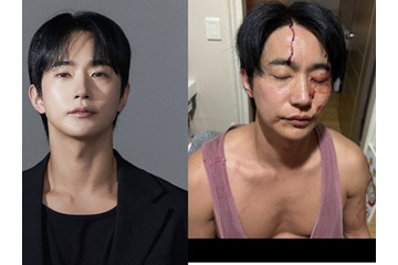 「性病をうつされ暴力もあった」と告発された韓国俳優が反論「彼女に殴られた」 画像