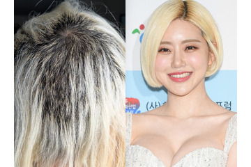 DJ SODAが見るも無残な状態に、一体何が？「髪もどんどん抜けて…」日本でのセクハラ被害で話題に 画像