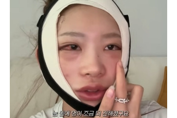 まるで“顔面フルリフォーム”…急逝した元巨人投手・国民的女優が両親　韓国インフルエンサーが大規模整形 画像