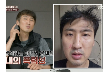 妻のDVで夫の眼球は破裂寸前に…“10カ月スピード婚”の韓国夫婦に起こった悲劇「離婚した方がいい」 画像