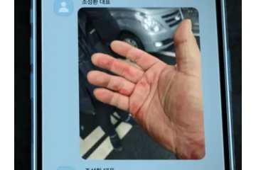 暴行の跡まで!! Ｊリーグのパワハラ問題に匹敵するか。韓国“ランシュー界の帝王”パワハラ事件の真相はいかに 画像