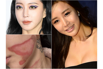 整形に美容施術、もはや“美”は金で買う時代　その裏に潜むリスクに直面した韓国芸能人たち 画像