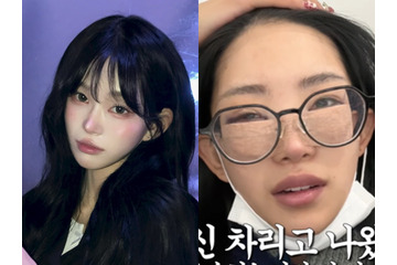 父は元巨人投手 韓国インフルエンサー、整形手術後の腫れた顔を赤裸々に公開 画像